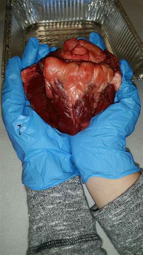 heart3 